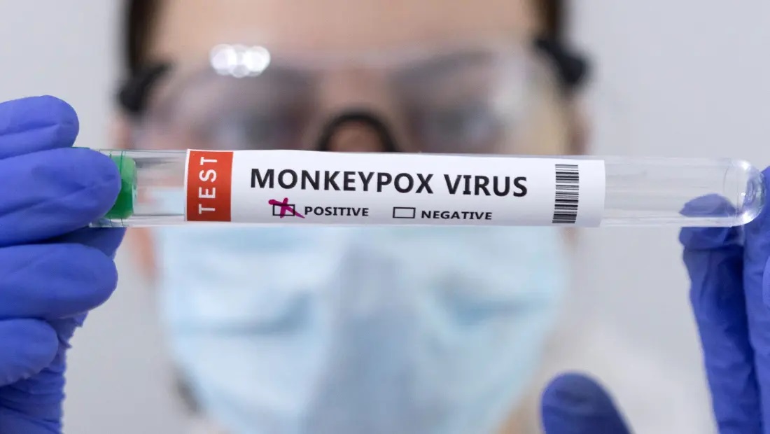 A new oddity about monkeypox: the country where the virus is less aggressive